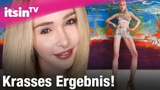 Theresia Fischer schockt mit neuem Foto - so krass sind ihre Beine | It's in TV