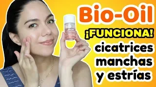 BIO-OIL PARA ELIMINAR MANCHAS, CICATRICES Y ESTRÍAS ¿FUNCIONA? | MARIEBELLE COSMETICS