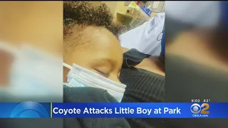 Coyote Attacks 2-Year-Old Child At El Cariso Park In Sylmar