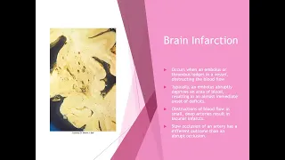 Chapter 26 Nervous System Blood Supply