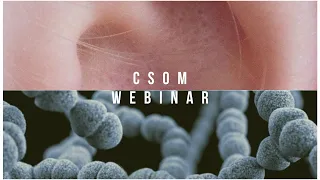 CSOM | The White Army Webinar