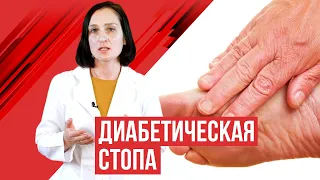 Диабетическая стопа: определение и профилактика