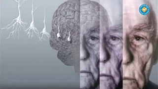 Нормално и патологично стареене на мозъка