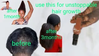 wow 🔥 I can't believe this can grow my hair this fast and long||Ebere Diy