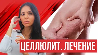 Целлюлит. Профилактика и лечение