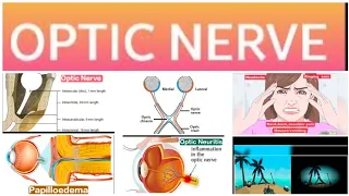 Optic Nerve 1(Major): Anatomy and Physiology,Optic Disc Edema