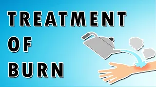 Treatment of Burn - 1st Degree, 2nd Degree, and 3rd Degree