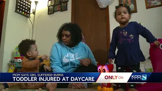 Iowa mother believes daughter was burned by bleach at daycare