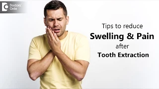 How to manage swelling & pain post tooth extraction? - Dr. Chandan Mahesh