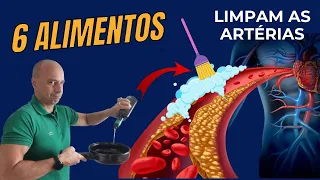 6 ALIMENTOS Para LIMPAR suas Artérias || Dr. Moacir Rosa