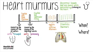 Heart Murmurs Overview (Heart Murmur Series)