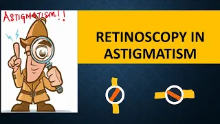 RETINOSCOPY in ASTIGMATISM | Break, intensity , brightness and skew | Straddling