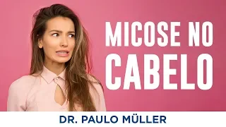 Micose nos Cabelos (Micose no Couro Cabeludo) - Dr. Paulo Müller Dermatologista