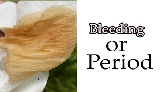 implantation bleeding vs period