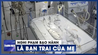 Bé gái hơn 2 tháng tuổi bị bạo hành nguy kịch