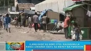 BP: DOH, nagpaalala sa publiko na mag-ingat laban sa mga karaniwang sakit tuwing tag-init