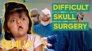 Doctors Save The Life Of A Young Girl With Apert Syndrome | Body Bizarre