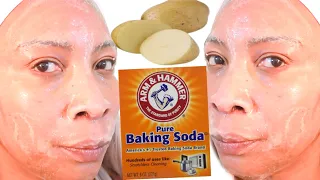 AMAZING BAKING SODA POTATO FACE SCRUB FOR BRIGHTER, YOUNGER RADIANT GLOWING SKIN, SHRINK OPEN PORES