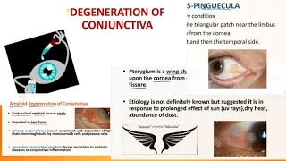conjunctival degeneration | pinguecula | pterygium |concretion| ophthalmology | symptoms & treatment