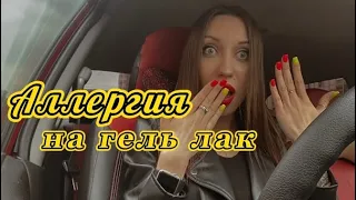 Аллергия на гель лак | Какой есть выход?