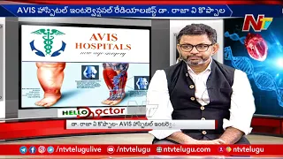 Main Causes Of Varicose Veins Explained By Dr. Rajah V Koppala | Avis Hospitals