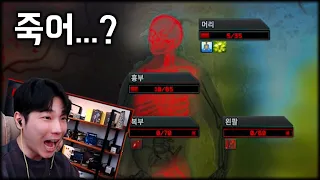 죽는다고!!!!