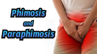 Phimosis and Paraphimosis - CRASH! Medical Review Series