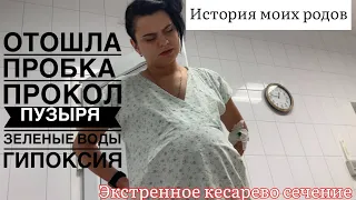 Мои роды 🥹 Я РОДИЛА 👨‍👩‍👦 отошла пробка • амниотомия • зелёные воды • экстренное кесарево сечени