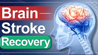 Brain Stroke Recovery | Paralysis Causes & Treatment | Dr. Puru Dhawan