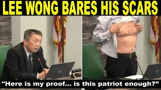 The timing was right West Chester trustee Lee Wong shares why he chose to bare his scars | Reaction