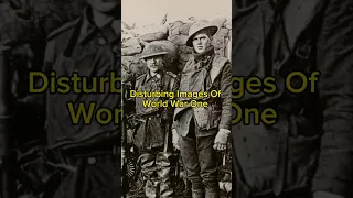 Disturbing Images Of World War One #ww1 #warshorts #military #warhistory #disturbing