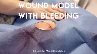 Mad Simulationist's Lab #1: Wound Model with Bleeding