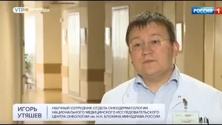 Онкоцентр Блохина: влияние солнца на развитие раковых клеток