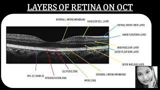 Learn How To Identify Retinal Layers on OCT | Retina | Ophthalmology