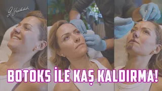 15 Dakikada Botoks İle Kaş Kaldırma! Op. Dr. Güray Yeşiladalı #botoks #botox #Shorts