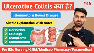 Ulcerative Colitis in Hindi | Inflammatory Bowel Disease in Hindi | Causes, Symptoms And Management