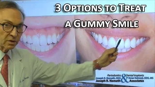 3 Options to Treat a Gummy Smile: Doctors Advice