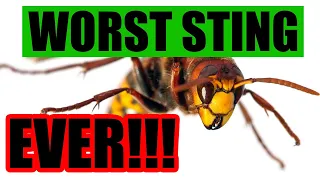 The Top 5 Worst Stings Ever! - What Hurts Worst from an Expert who KNOWS