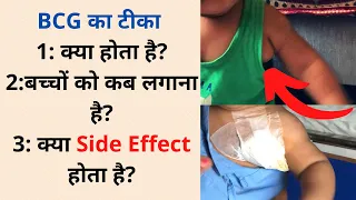 BCG Vaccine For Newborn Baby| BCG Vaccination In Hindi