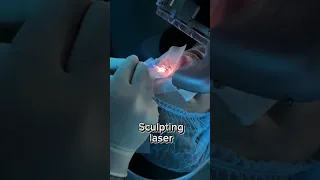 LASIK laser eye surgery - let’s go! 🙌