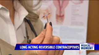 What are Long Acting Reversible Contraceptives?