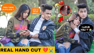 Hand Cut Prank || Prank On Girlfriend (Gone Extremely Wrong 😱) || Justin Romio