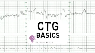 CTG Basics