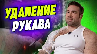 💪Зачем качок решил свести тату? Что из этого вышло? | Лазерное удаление большой тату на руке