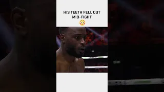 His teeth fell out mid-fight 😳