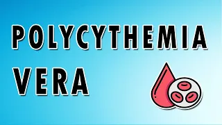 Managing Polycythemia Vera: A Comprehensive Guide