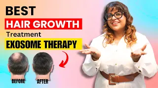 Exosome Hair Growth Treatment: Revolutionary Solution for Hair Fall & Hair Loss | Dr. Sneha Gupta MD