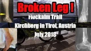 Broken Leg -  Fleckalm Trail, Tyrol Austria