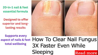 Simple 7-second "Fungus Vanishing" Ritual Clears Nails 3X Faster - Simple Nails Ritual