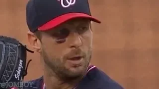 Max Scherzer strikes out ten batters with a broken nose, a breakdown